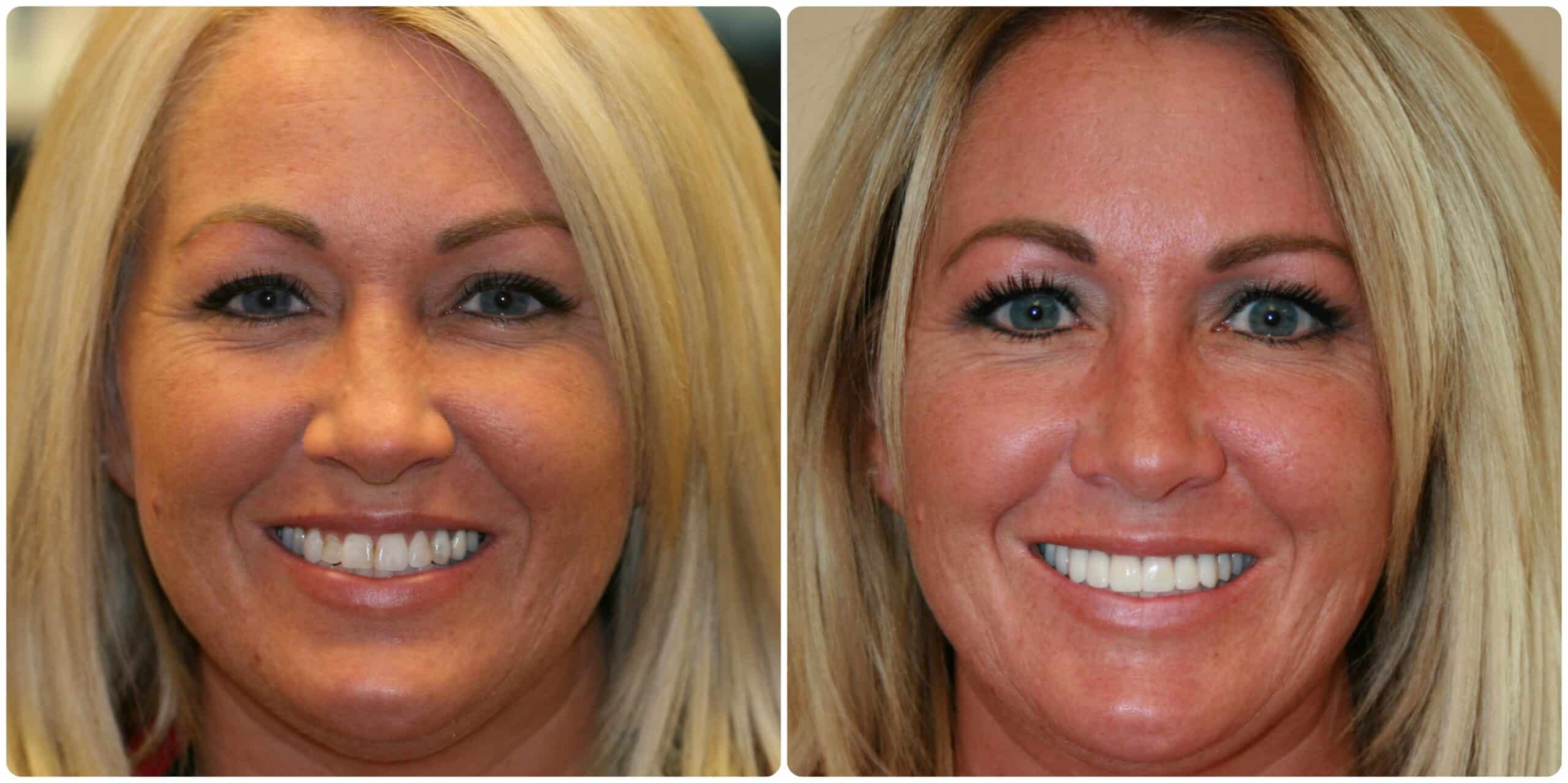 Best Cosmetic Dentist in Idaho Falls, ID Ammon Dentist