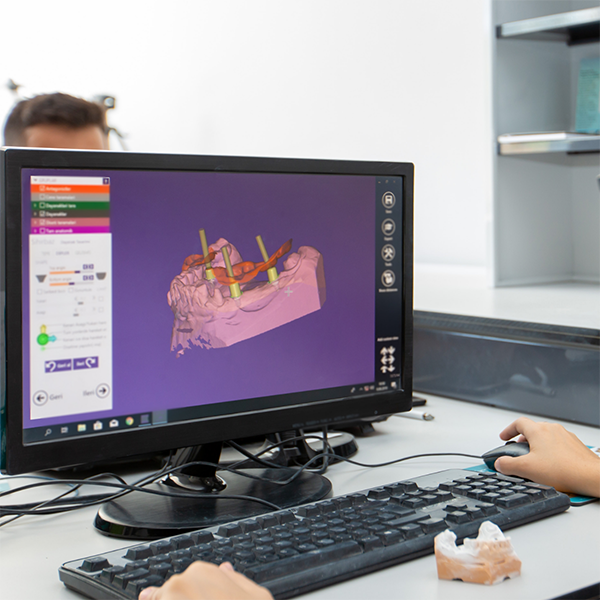 Computer showing illustration of dental modal.