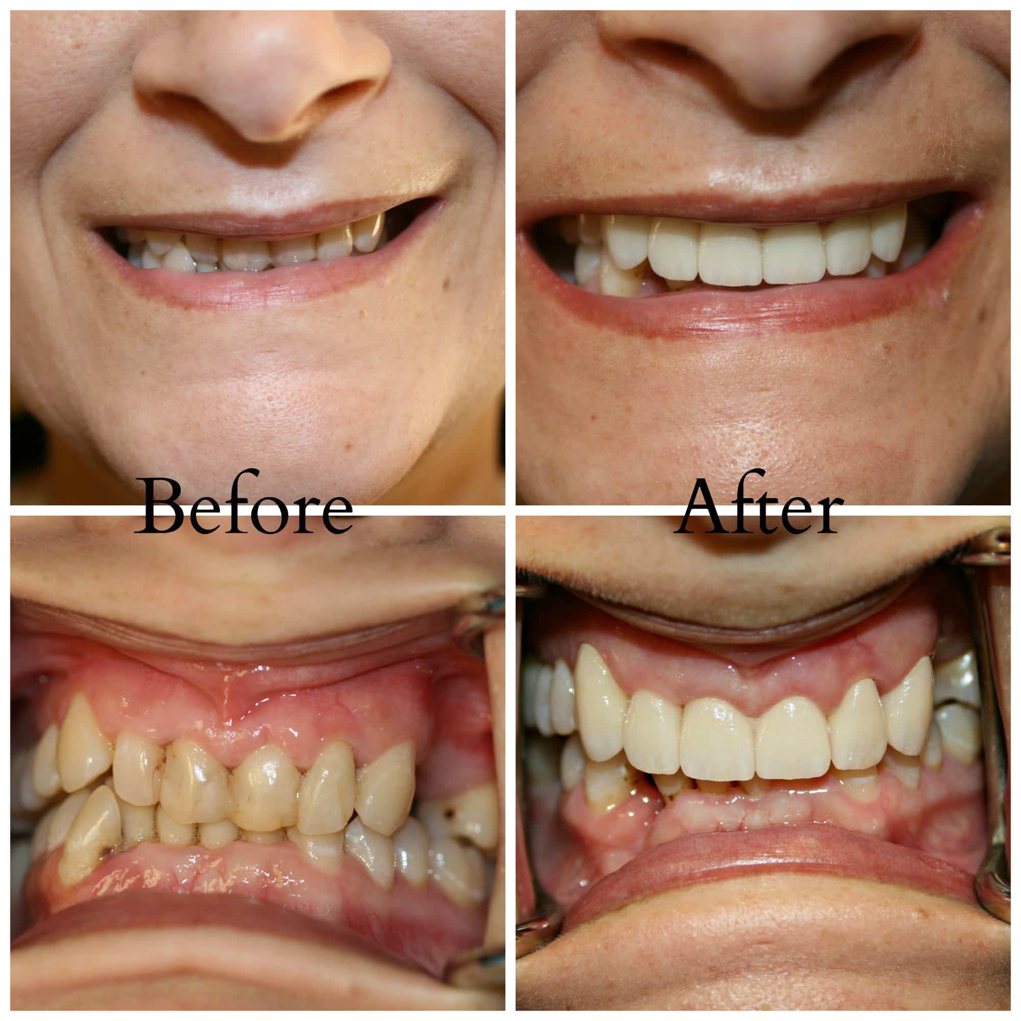 Best Cosmetic Dentist in Idaho Falls, ID Ammon Dentist